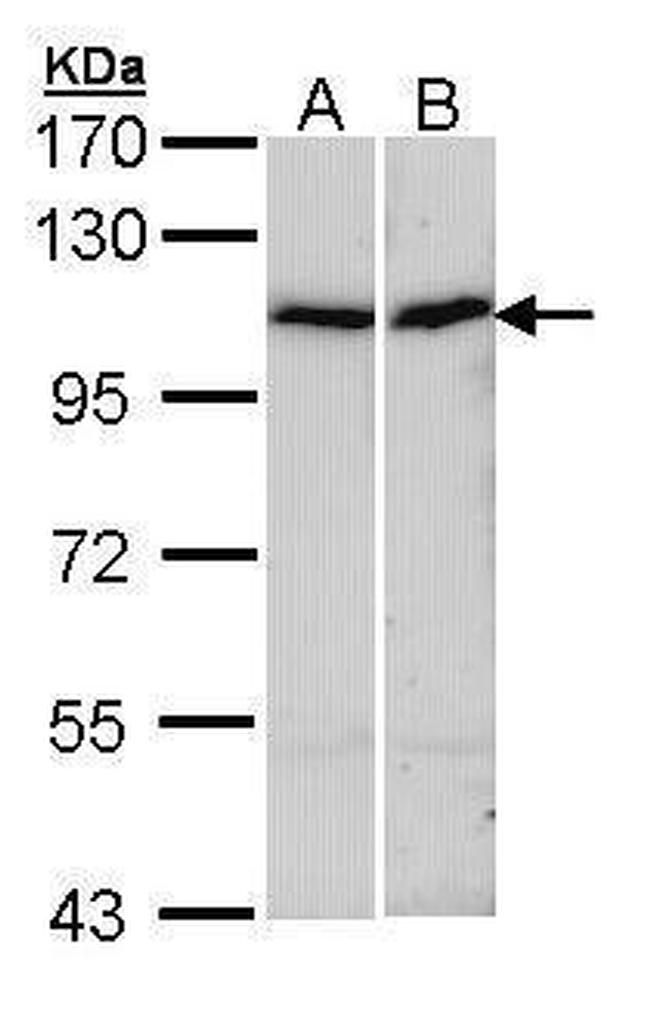 alpha Actinin 4 Antibody in Western Blot (WB)