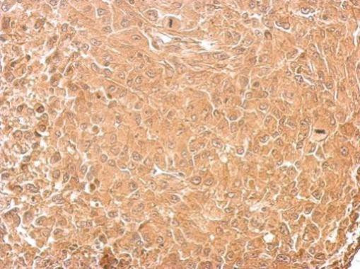 GAD65 Antibody in Immunohistochemistry (Paraffin) (IHC (P))