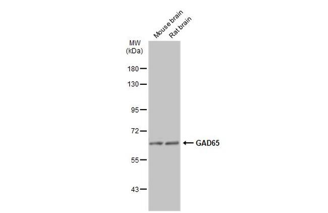 GAD65 Antibody in Western Blot (WB)