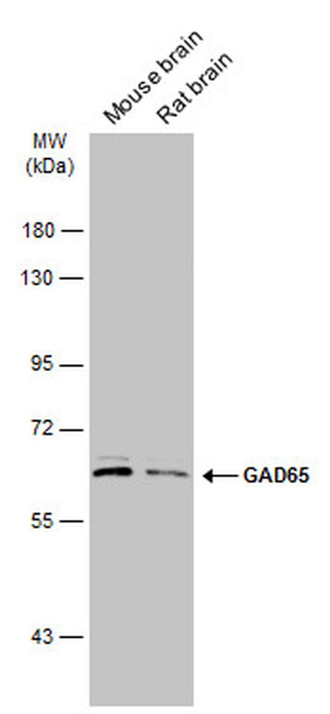 GAD65 Antibody in Western Blot (WB)