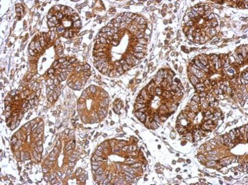 GNAS Antibody in Immunohistochemistry (Paraffin) (IHC (P))