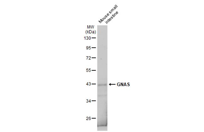 GNAS Antibody in Western Blot (WB)