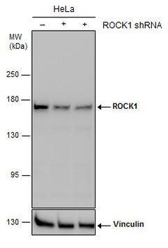 ROCK1 Antibody