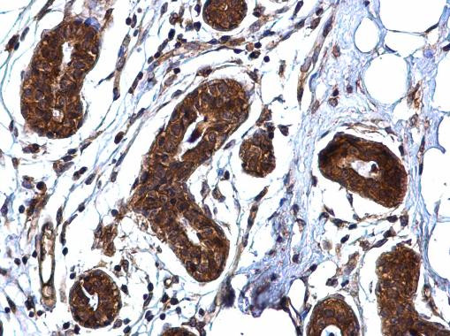 ROCK1 Antibody in Immunohistochemistry (Paraffin) (IHC (P))