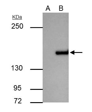 ROCK1 Antibody in Immunoprecipitation (IP)