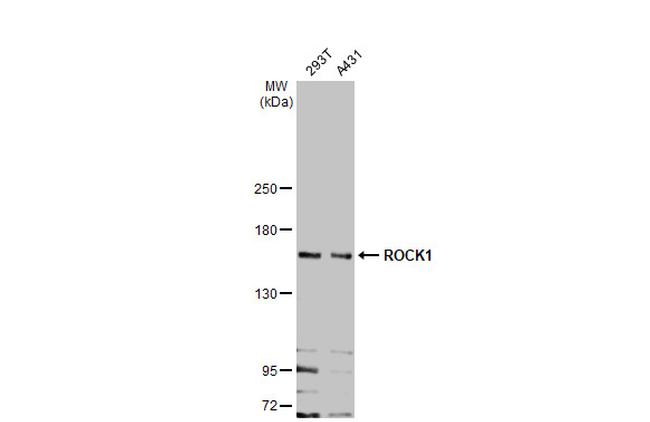 ROCK1 Antibody in Western Blot (WB)