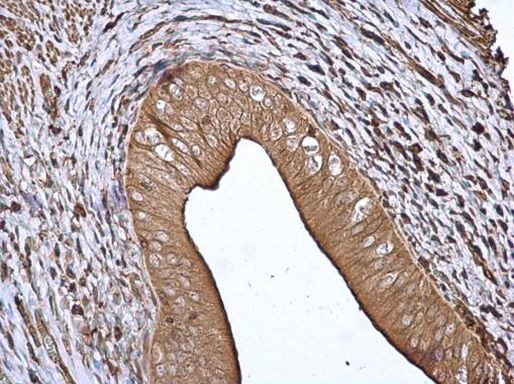 14-3-3 beta Antibody in Immunohistochemistry (Paraffin) (IHC (P))