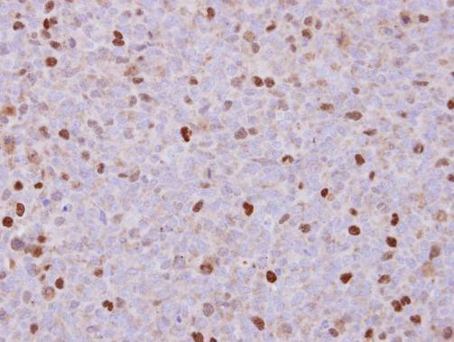 RACGAP1 Antibody in Immunohistochemistry (Paraffin) (IHC (P))