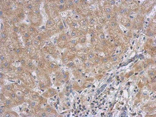 RACGAP1 Antibody in Immunohistochemistry (Paraffin) (IHC (P))