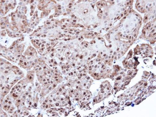 Annexin A1 Antibody in Immunohistochemistry (Paraffin) (IHC (P))