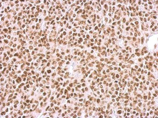 BCCIP Antibody in Immunohistochemistry (Paraffin) (IHC (P))