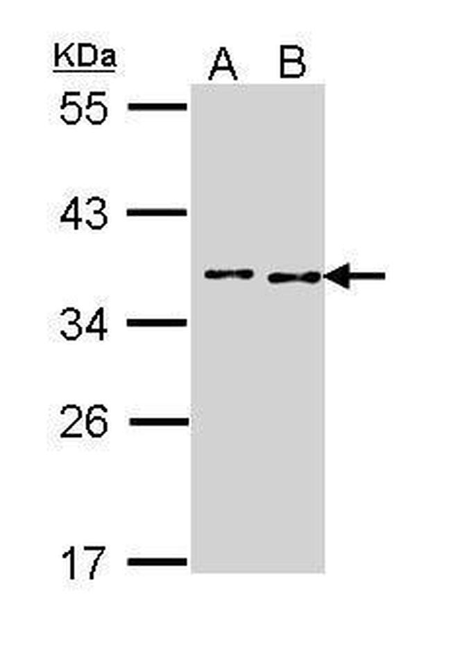 BCCIP Antibody in Western Blot (WB)