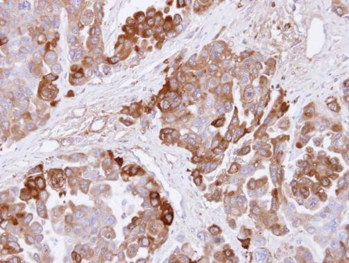 CBS Antibody in Immunohistochemistry (Paraffin) (IHC (P))