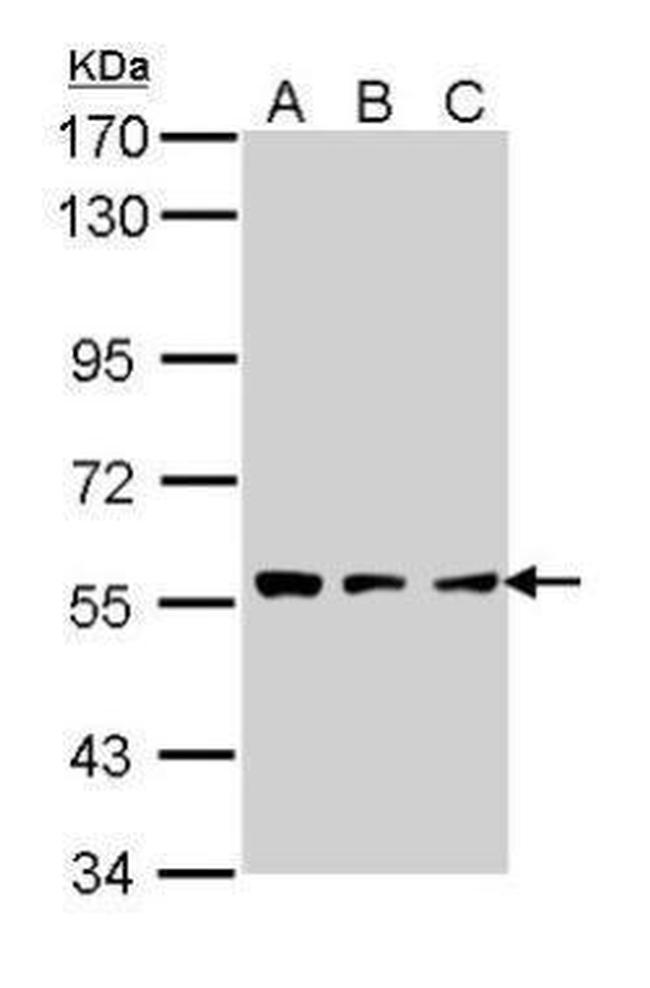 CLN2 Antibody in Western Blot (WB)