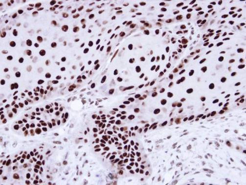 hnRNP C Antibody in Immunohistochemistry (Paraffin) (IHC (P))