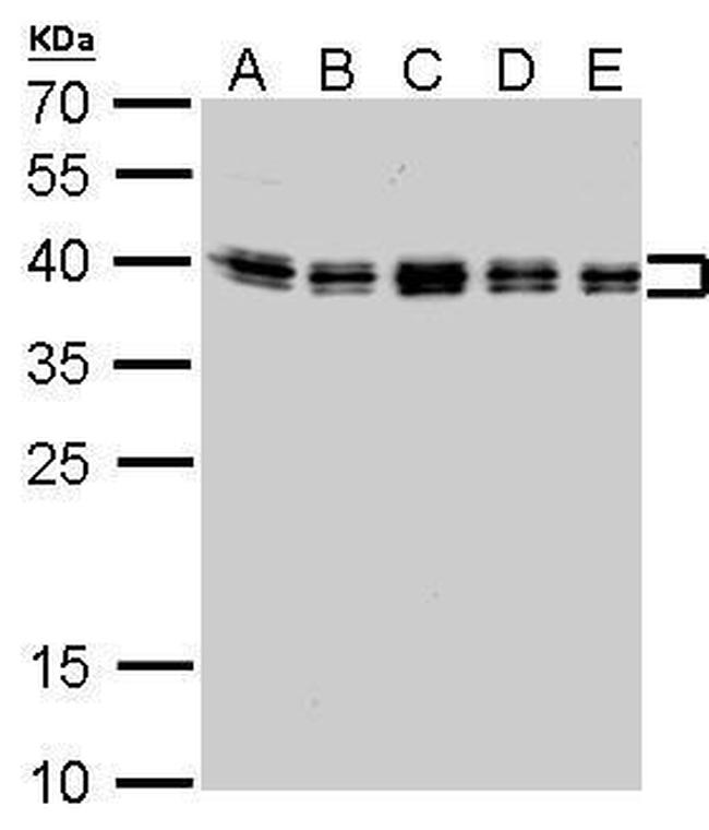 hnRNP C Antibody in Western Blot (WB)