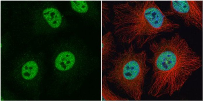 hnRNP C Antibody in Immunocytochemistry (ICC/IF)