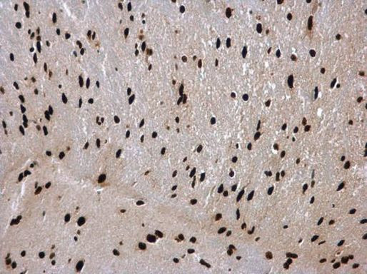 hnRNP C Antibody in Immunohistochemistry (Paraffin) (IHC (P))