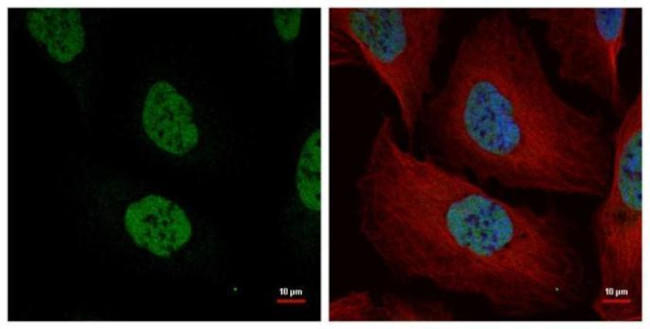 NuMA Antibody in Immunocytochemistry (ICC/IF)