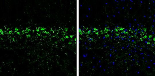 Prodynorphin Antibody in Immunohistochemistry (Frozen) (IHC (F))