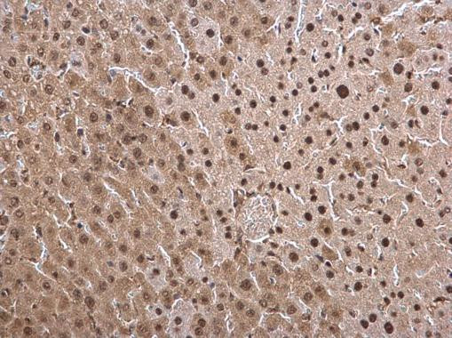 PSMB8 Antibody in Immunohistochemistry (Paraffin) (IHC (P))