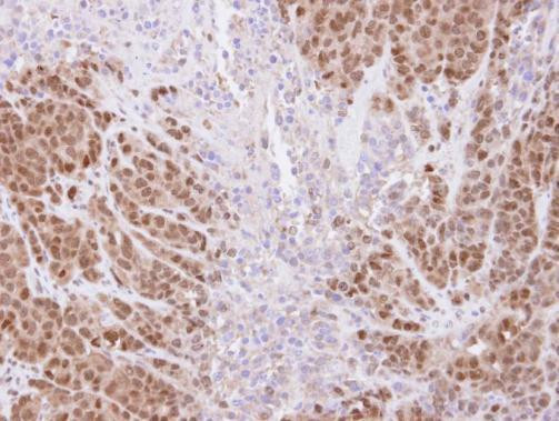 TRIM21 Antibody in Immunohistochemistry (Paraffin) (IHC (P))