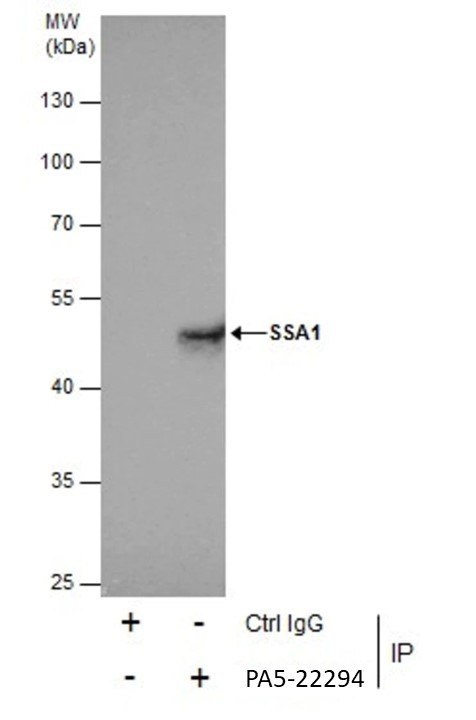 TRIM21 Antibody in Immunoprecipitation (IP)