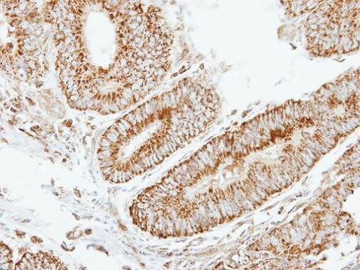 eIF2b beta Antibody in Immunohistochemistry (Paraffin) (IHC (P))