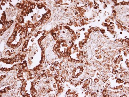 MVP Antibody in Immunohistochemistry (Paraffin) (IHC (P))