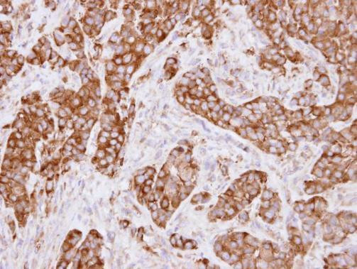 MVP Antibody in Immunohistochemistry (Paraffin) (IHC (P))