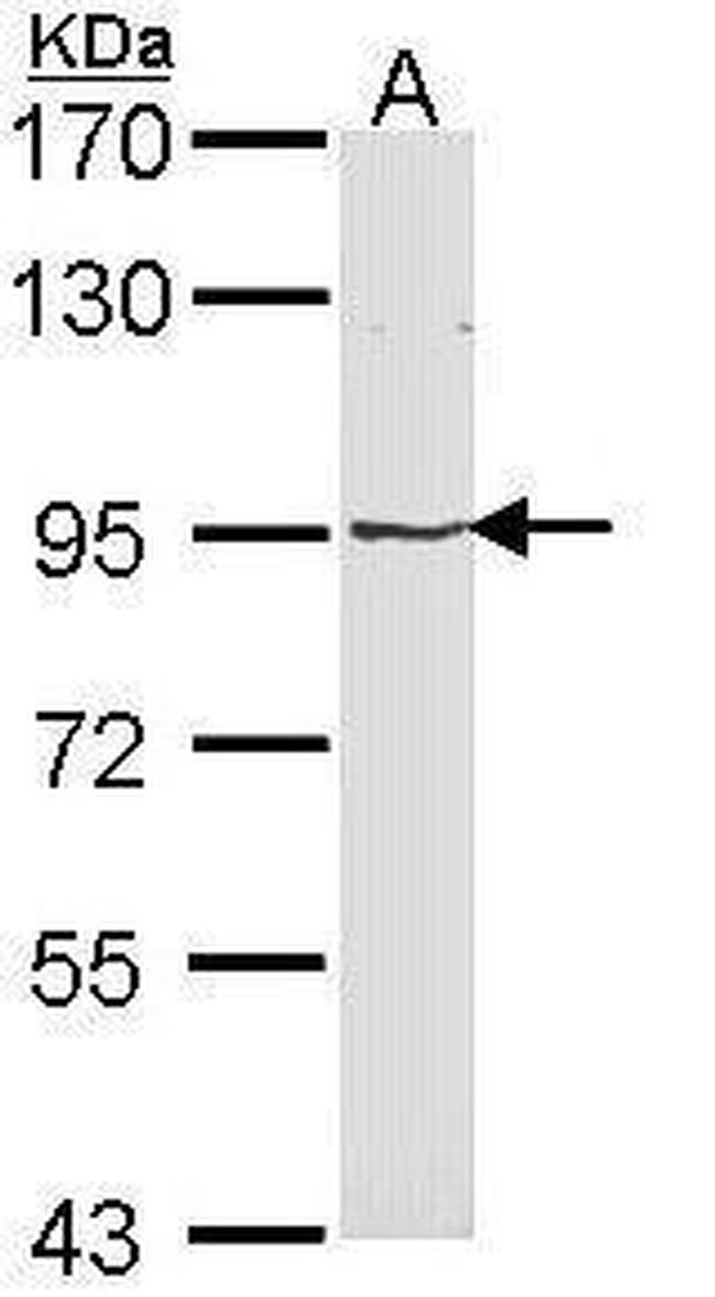 MVP Antibody in Western Blot (WB)