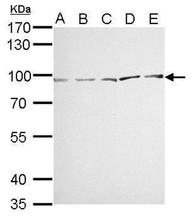 MVP Antibody in Western Blot (WB)