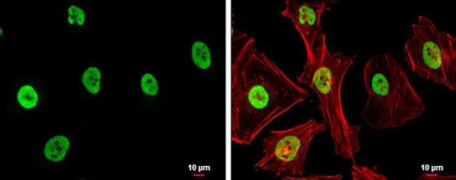 SAE1 Antibody in Immunocytochemistry (ICC/IF)