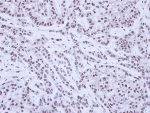 SAE1 Antibody in Immunohistochemistry (Paraffin) (IHC (P))