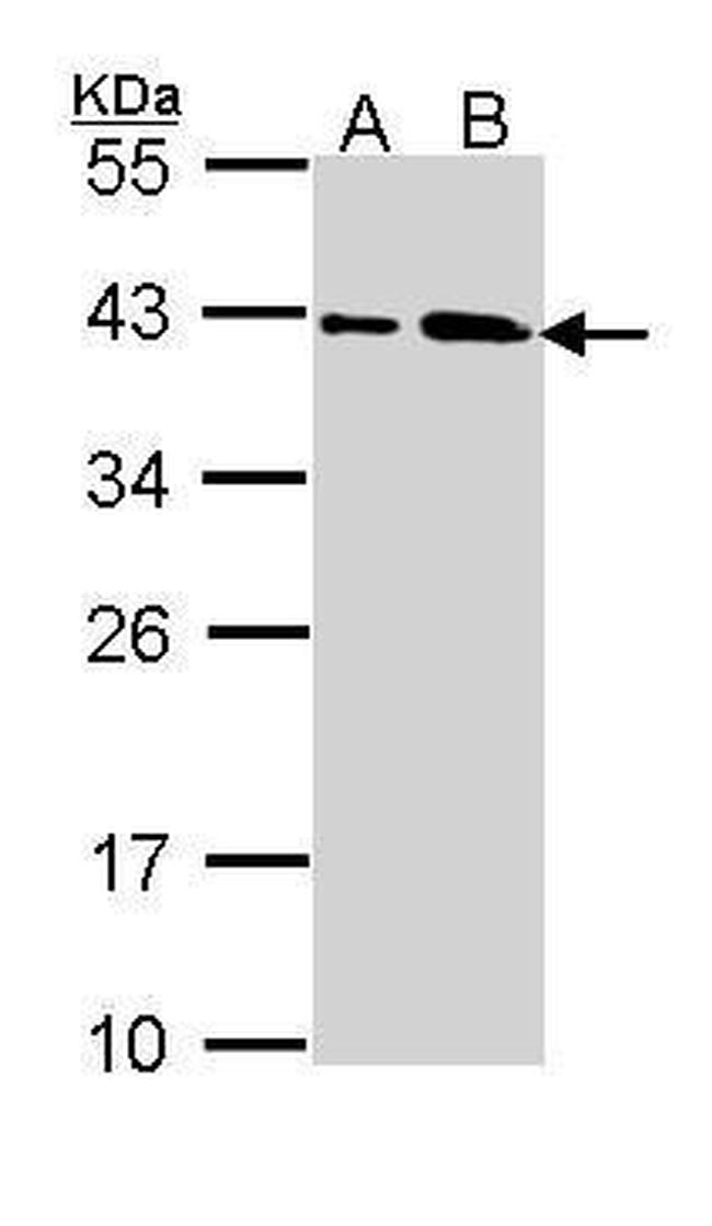 SAE1 Antibody in Western Blot (WB)