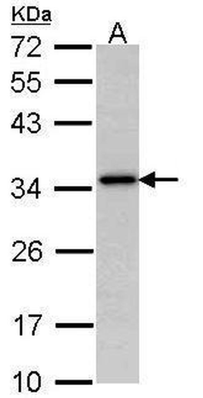 NAT1 Antibody in Western Blot (WB)