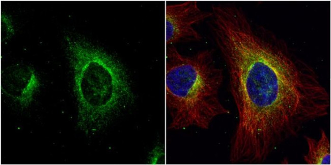 ASL Antibody in Immunocytochemistry (ICC/IF)