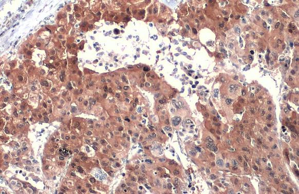 ASL Antibody in Immunohistochemistry (Paraffin) (IHC (P))