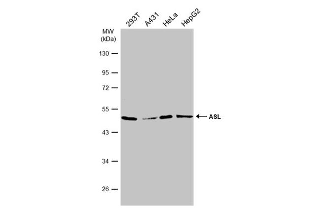 ASL Antibody in Western Blot (WB)