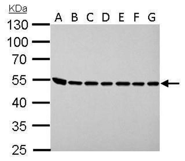 ASL Antibody in Western Blot (WB)