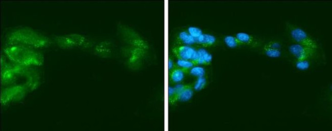 Factor IX Antibody in Immunocytochemistry (ICC/IF)