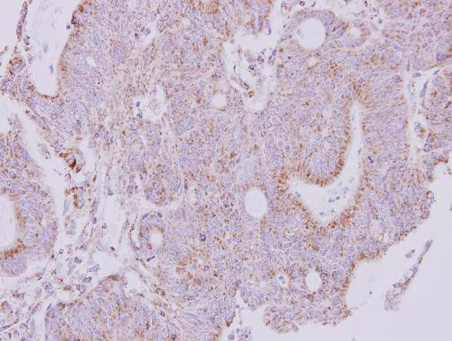 NDUFS1 Antibody in Immunohistochemistry (Paraffin) (IHC (P))