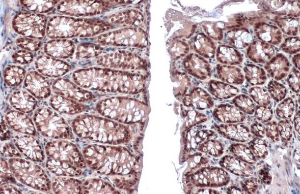 HNF1A Antibody in Immunohistochemistry (Paraffin) (IHC (P))