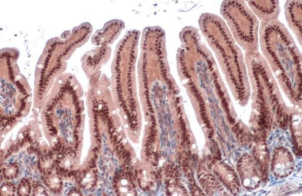 HNF1A Antibody in Immunohistochemistry (Paraffin) (IHC (P))