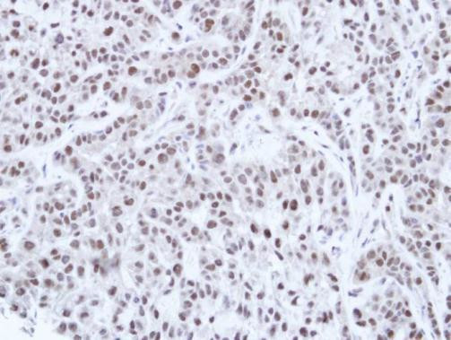 HNF1A Antibody in Immunohistochemistry (Paraffin) (IHC (P))