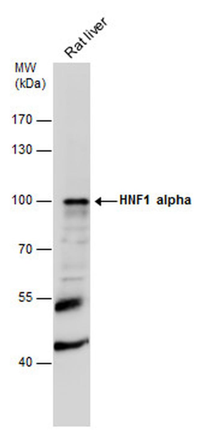 HNF1A Antibody in Western Blot (WB)