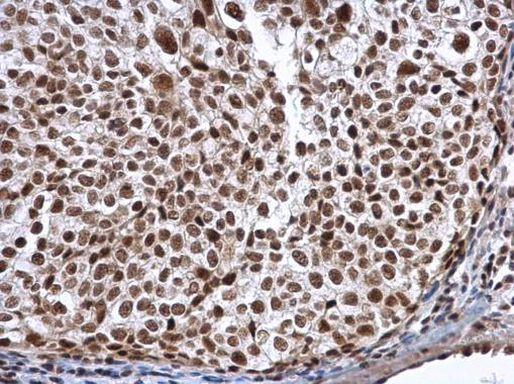 ALY Antibody in Immunohistochemistry (Paraffin) (IHC (P))