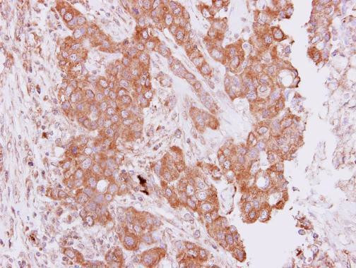 PIM2 Antibody in Immunohistochemistry (Paraffin) (IHC (P))