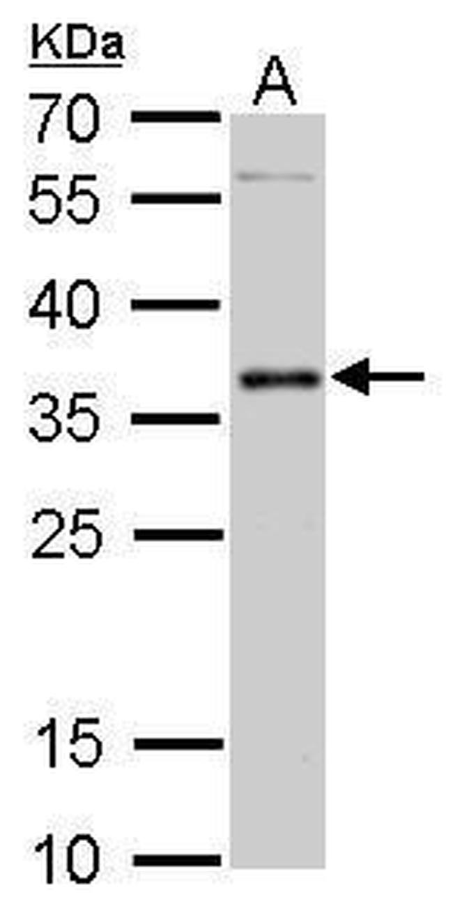 PIM2 Antibody in Western Blot (WB)