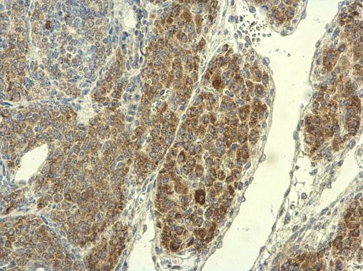 PADI4 Antibody in Immunohistochemistry (Paraffin) (IHC (P))